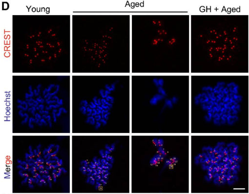 Representative images of chromosome spreading (cat. 15-234, 1:200) of euploid and aneuploid mouse oocytes. Image from publication CC-BY-4.0. PMID:37386516