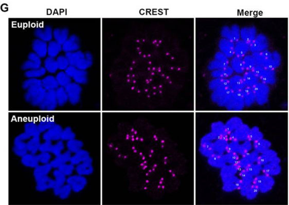C3a-peptide treatment does not induce chromosome aneuploidy of mouse oocytes. Representative images of MII oocyte immunofluorescence stained with DAPI (blue) and anti-CREST (cat. 15-234, 1:500; magenta) antibodies showing euploidy and aneuploidy in the oocytes, respectively (left). Image from publication CC-BY-4.0. PMID:38066646