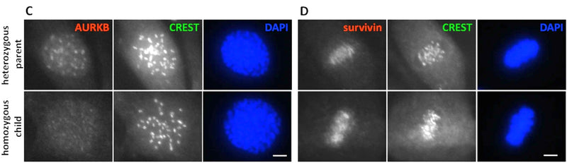 Representative images of heterozygous (top) and homozygous (bottom) fibroblasts stained with AURKB (C, prophase) or survivin (metaphase, D) (red; shown in grayscale) and FITC-conjugated CREST (cat. 15-235-F, 1:100, green; shown in grayscale). Image from publication CC-BY-4.0. PMID:28272472