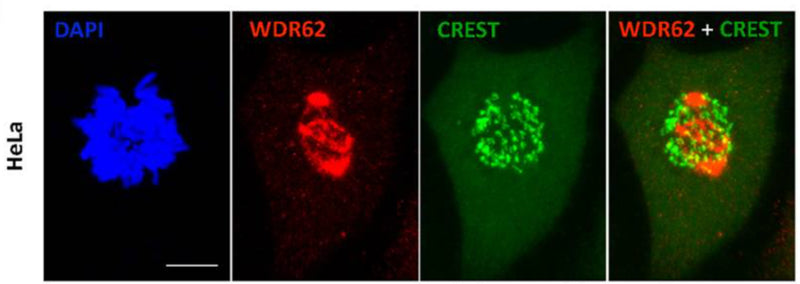 Immunofluorescence staining of fibroblasts shows partial and transient localization of WDR62 (red) in prometaphase kinetochores (CREST, cat. 15-235-F, 1:100). Image from publication CC-BY-4.0. PMID:28272472