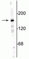 Western blot of 10 µg of rat hippocampal lysate showing specific immunolabeling of the ~180 kDa NR2A subunit. 