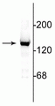 Western blot of 10 µg of rat cerebellar lysate showing specific immunolabeling of the ~140 kDa NR2C subunit of the NMDA receptor. 
