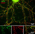 Immunostaining of 14 DIV rat cortical neurons showing NR2B (green, 1:400) and PSD95(red). Photo courtesy of Gang Liu. 