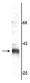 Western blot of rat synaptic plasma membrane (SPM) lysate showing specific immunolabeling of the ~36 kDa stargazin protein. 