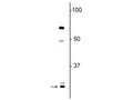Western blot of neonatal rat brain lysate showing specific immunolabeling of the ~ 27 kDa Olig1 protein.