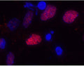 Immunostaining of primary rat cortical neuroepithelial cells with anti-Olig2 (Cat. 1538-OLIG2, red, 1:1000). The cells were treated with basic FGF for 30 hours prior to staining (this induces Olig2 expression in