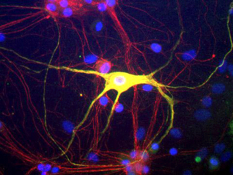 Immunoflourescence of cultured rat neurons and glia showing peripherin (cat.  1631-PER, green, 1:500) and alpha-internexin (red). The blue stain is nuclear DNA. Cells expressing both peripherin and alpha-internexin appear yellow. 