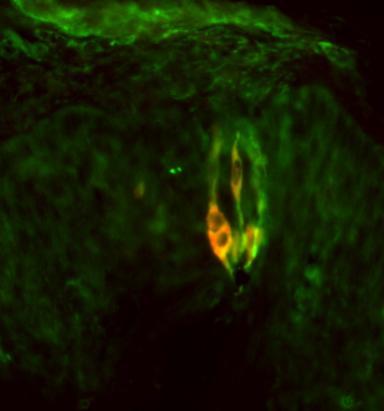 Immunostaining of human larynx taste bud showing specific labeling of PLC β2 (red) and GNAT3 (green). Photo courtesy of Mei Li, University of Colorado-Anschutz MC.