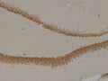 Immunostaining of rat dentate gyrus showing specific immunolabeling of the Prox1 protein(DAB, 1:1000). Photo courtesy of Justin Kievits and Teresa Milner, Weill Cornell Medical College.