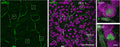 Human ganglion cell layer (GCL) labelled for BNC2 and RBPMS (Cat. 1830-RBPMS) with example RGC11 cells in ROIs. ROI 1 and ROI 2 are shown enlarged on the right. Images in b