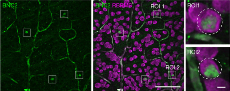 Human ganglion cell layer (GCL) labelled for BNC2 and RBPMS (cat. 1830-RBPMS) with example RGC11 cells in ROIs. ROI 1 and ROI 2 are shown enlarged on the right. Images in b were 2D median filtered before maximal z-projection of the GCL. Image from publication CC-BY-4.0. PMID: 37880369