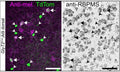 Confocal micrograph of melanopsin, TdTomato, and RBPMS (Cat. 1832-RBPMS) co-staining in the dorsal GlyT2Cre;Ai9 mouse retina. The left arrows indicate RBPMS-positive GlyT2Cre ipRGCs. All melanopsin-negative, TdTomato-positive cells are RBPMS