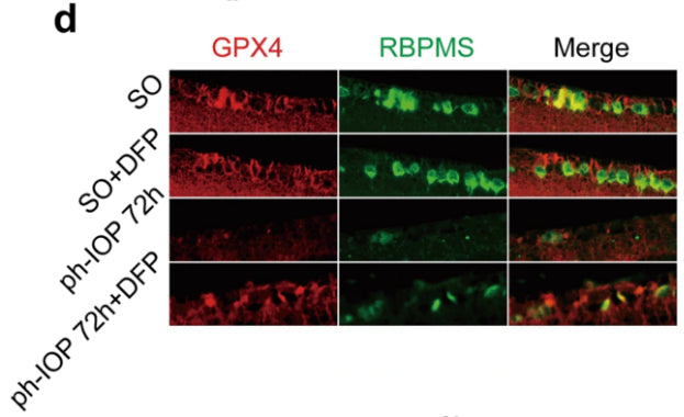 Immunostaining of GPX4 (red) in retinal ganglion cells (counterstained with RBPMS; green) in sham operation (SO) and ph-IOP injured mice, with or without DFP treatment. Image from publication CC-BY-4.0. PMID: 35933500