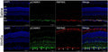 Upper panel shows representative images of cross-sections of saline-injected mouse retinas and lower panel shows representative images of cross-sections of 50 ng Wnt5a-injected mouse retinas co-immunostained with phospho CamKII (green), RBPMS (red), and DAPI (blue). Image from publication CC-BY-4.0. PMID: 35914928