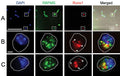 Purified mouse RGCs in culture that have been probed by FISH for Runx1(red), immunostained with an RGC marker RBPMS(green, cat. 1832-RBPMS), and DAPI(blue). (A) An section where two Runx1+ RGCs outlined with dashed box are shown enlarged below (B,C; cell soma