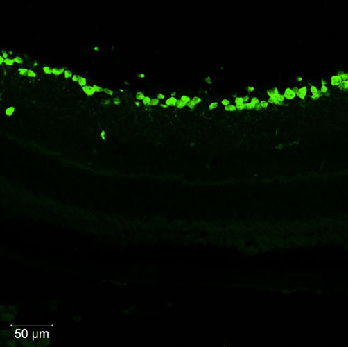 Representative section of mouse retina showing cells stained by anti-RBPMS antibody. The sections were
stained with PhosphoSolutions anti-RBPMS recombinant guinea pig monoclonal antibody (visualized in green) (Cat No. 1834-RBPMS) at 1:1000 dilution. Anti-RBPMS specifically stains the retinal ganglion cells in the mouse retina.​ Image courtesy of Angela Wong, UCLA.