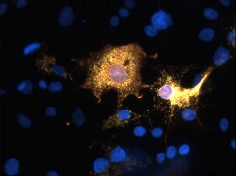Immunofluorescence of transfected COS-7 cells specifically labeling the positive SARM1 cells using our anti-SARM1 antibody (1:50, red) and anti-FLAG antibody (green). The yellow color results from the overlap of cells labeled with both antibodies. DNA is labeled with DAPI (blue).