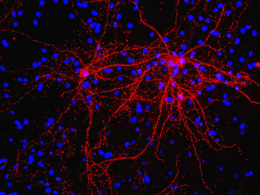 Immunostaining of 40DIV cultured rat cortical neurons showing punctate labeling of synapsin (cat. 1926-SYNP, 1:1000, red). The blue is staining nuclear DNA. Cells and photo courtesy of QBMCellScience.