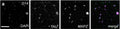 Day 14 (D14) RGC-iNs stained with a DAPI, TAU (Cat. 1998-TAU, 1:1000), and MAP2. Image from publication CC-BY-4.0. PMID: 37773257