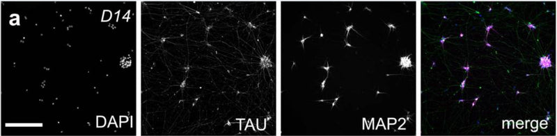 Day 14 (D14) RGC-iNs stained with a DAPI, TAU (cat. 1998-TAU, 1:1000), and MAP2. Image from publication CC-BY-4.0. PMID: 37773257