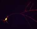 Immunostaining of cultured rat hippocampal neurons stained with anti-TAU antibody (Cat. 1998-TAU, red, 1:1000) along the neuronal processes.
