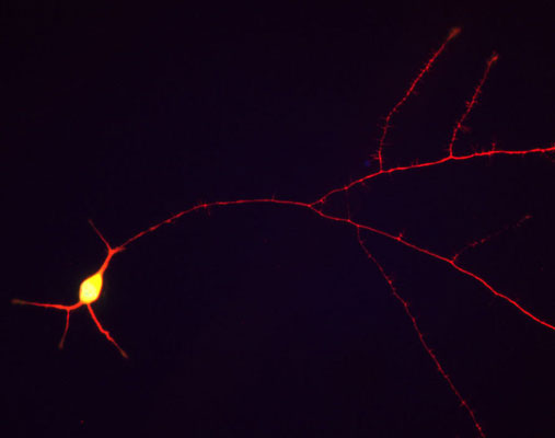 Immunostaining of cultured rat hippocampal neurons stained with anti-TAU antibody (cat. 1998-TAU, red, 1:1000) along the neuronal processes.