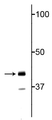 Western blot of neonatal rat brain lysate showing specific immunolabeling of the ~43 kDa TDP43 protein. 