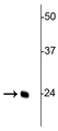 Western blot of rat kidney lysate showing specific immunolabeling of the ~24 kDa TFAM protein. 