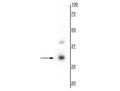 Western blot of mouse whole brain lysate showing specific immunolabeling of the ~28 kDa TREM2 protein.