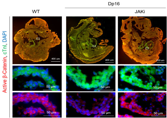 Examination of cardiac troponin I (cTnI) (cat. 2010-TNI, green) and active β-Catenin (red) levels in embryos at E9.5 by immunofluorescence (IF) analysis. Pregnant mice were treated daily with vehicle or the JAKi (10 mg/kg body weight/day, i.p.) beginning with day 6.5 post-conception. Embryos were harvested at E9.5 for IF analysis. Image from publication. CC-BY-4.0