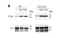 Western blots showing specific labeling of S23/S24 TnI, cat. p2010-2324 (upper) and TnI;cat. 2010-TnI (lower) in protein lysates of mouse cardiomyocytes. Image from publication CC-BY-4.0. PMID: 36424916