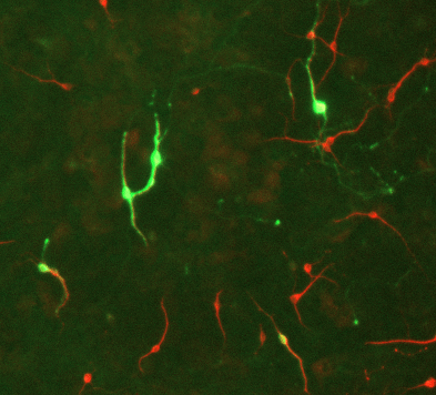 Immunostaining of E17 rat midbrain mixed neuronal cultures showing TH positive neurons (cat.  2025-THRAB, green, 1:500) and MAP2 (cat. 1100-MAP2, red, 1:2000). Before labeling, cells were fixed with 4% PFA in PBS and permeabilized for 1 hour 0.3 % Triton X. Image courtesy of Aurélie de Rus Jacquet, laboratory of Dr. Jean-Christophe Rochet, Purdue University.