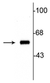Western blot of 10ug of rat striatal lysate showing specific immunolabeling of the ~60 kDa tyrosine hydroxylase protein.
