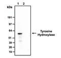 Western blot detection of tyrosine hydroxylase in rat caudate fraction (lane 1, high expression) and NIH3T3 (lane 2, low expression/negative control) cell lysates using PhosphoSolutions anti-Tyrosine Hydroxylase rabbit polyclonal antibody (Cat No. 2025-THRAB). 4-12% Bis-Tris gel was loaded with 15 µg of rat caudate fraction and NIH3T3 lysates. Proteins were transferred to PVDF membrane and blocked with 5% non-fat milk powder. Anti-Tyrosine Hydroxylase rabbit (Cat No. 2025-THRAB) (lanes 1, 2) antibodies were incubated with the membrane at a concentration of 1:1000. The primary antibodies were then detected via chemiluminescence (4 seconds) using a goat anti-Rabbit H+L, HRP conjugated secondary antibody. Anti-TH antibodies recognize tyrosine hydroxylase found in brain lysates at ~60 kDa and an absence in signal in mouse NIH3T3 cell lysates, consistent with low endogenous expression levels.