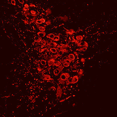 Immunostaining of free-floating sections of mouse locus ceruleus (brainstem) labeling tyrosine hydroxylase (Cat no 2027-THSHP, red, 1:2000) The mouse was transcardially perfused with 20 mL of PBS containing 0.1% procaine and 100 U/mL heparin followed by 20 mL of 4% paraformaldehyde (PFA) in PBS. The dissected brains were kept in fixative at 4 °C overnight. The image was kindly provided by Eugene Dimitrov, Department of Physiology and Biophysics, Rosalind Franklin University.