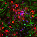 Immunostaining of E20 rat cortical neuron and glial culture stained with anti-UCHL1 antibody (Cat. 2061-UCHL1, red, 1:500) and rabbit anti-vimentin antibody (green). The blue is DAPI staining nuclear DNA. The anti-UCHL1 stains strongly the cell