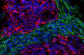 Immunoflourescence of mixed fibroblasts and PC12 cells labeled with anti-peripherin (Cat. 1630-PER, red, 1:500) and anti-vimentin (Cat. 2105-VIM, green, 1:10,000). The blue is Hoechst staining nuclear DNA. Peripherin is labeled in only the PC12 cells cytoplasmic filaments and