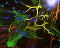 Immunostaining of mixed neuron/glial cultures stained with anti-Vimentin antibody (Cat. 2105-VIM, 1:500, green) and anti-GFAP antibody (Cat. 620-GFAP, 1:1000, red). Vimentin is expressed alone in fibroblastic and endothelial cells, which are the flattened cells in the middle of