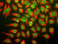 Immunostaining of HeLa cells stained with anti-nuclear pore complex antibody (Cat. 1515-NPC, green, 1:100) and rabbit anti-vimentin antibody (Cat. 2105-VIM, red, 1:500).