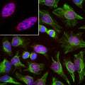 Immunoflourescence of HeLa cells labeled with anti-SAP49 (Cat. 1900-SAP, red, 1:1000) and anti-vimentin (Cat. 2105-VIM, green, 1:10,000). The blue is DAPI staining nuclear DNA.