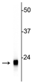 Western blot of rat cerebellar lysate showing specific immunolabeling of the ~22 kDa VSNL1 protein.