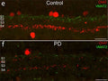 Immunostaining against ChAT (red) and VMAT2 (Cat. 2250-VMAT2C, 1:200, green) in retinal sections of control (e) and Parkinson's Desease (f) patients. Image from publication CC-BY-4.0. PMID:
