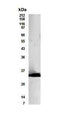 Western Blot of transfected 293 cell lysate showing specific immunolabeling of Bcl10. 