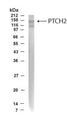 Western Blot of human fetal brain lysate showing specific immunolabeling of PTCH2. 