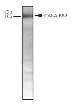 Western Blot of rat brain lysate showing specific immunolabeling of GABA-B R2.