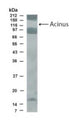 Western Blot of transfected COS-7 cells showing specific immunolabeling of Acinus. This antibody recognizes both long and short forms of Acinus protein.