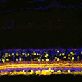 Immunohistochemistry of mouse retinal sections showing specific staining of SHANK1.