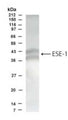Western Blot of T84 colon carcinoma cell lysate showing specific immunolabeling of ESE1. The antibody recognizes both isoforms of ESE1.