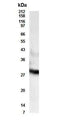 Western Blot of androgen stimulated metastatic adenocarcinoma LNCaP.FGC cells showing specific immunolabeling of RDH11. 