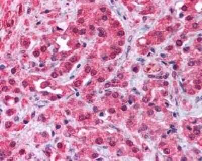 Immunohistochemistry of Formalin-Fixed Paraffin-Embedded (FFPE) prostate cancer cells showing specific staining of TRPM8. 